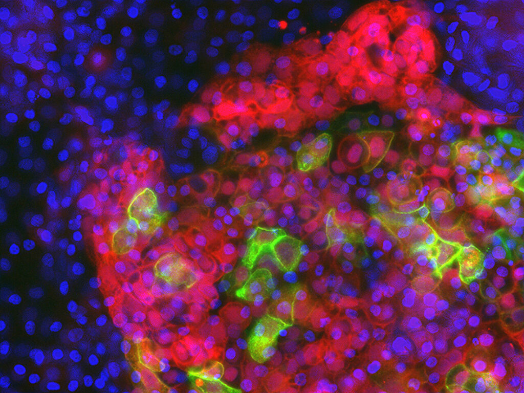 human thymus development