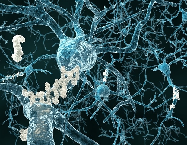 Alzheimer's unsaturated fats