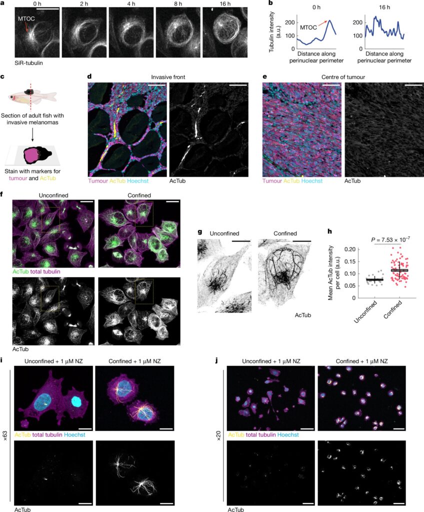 epigenetic changes cancer cells