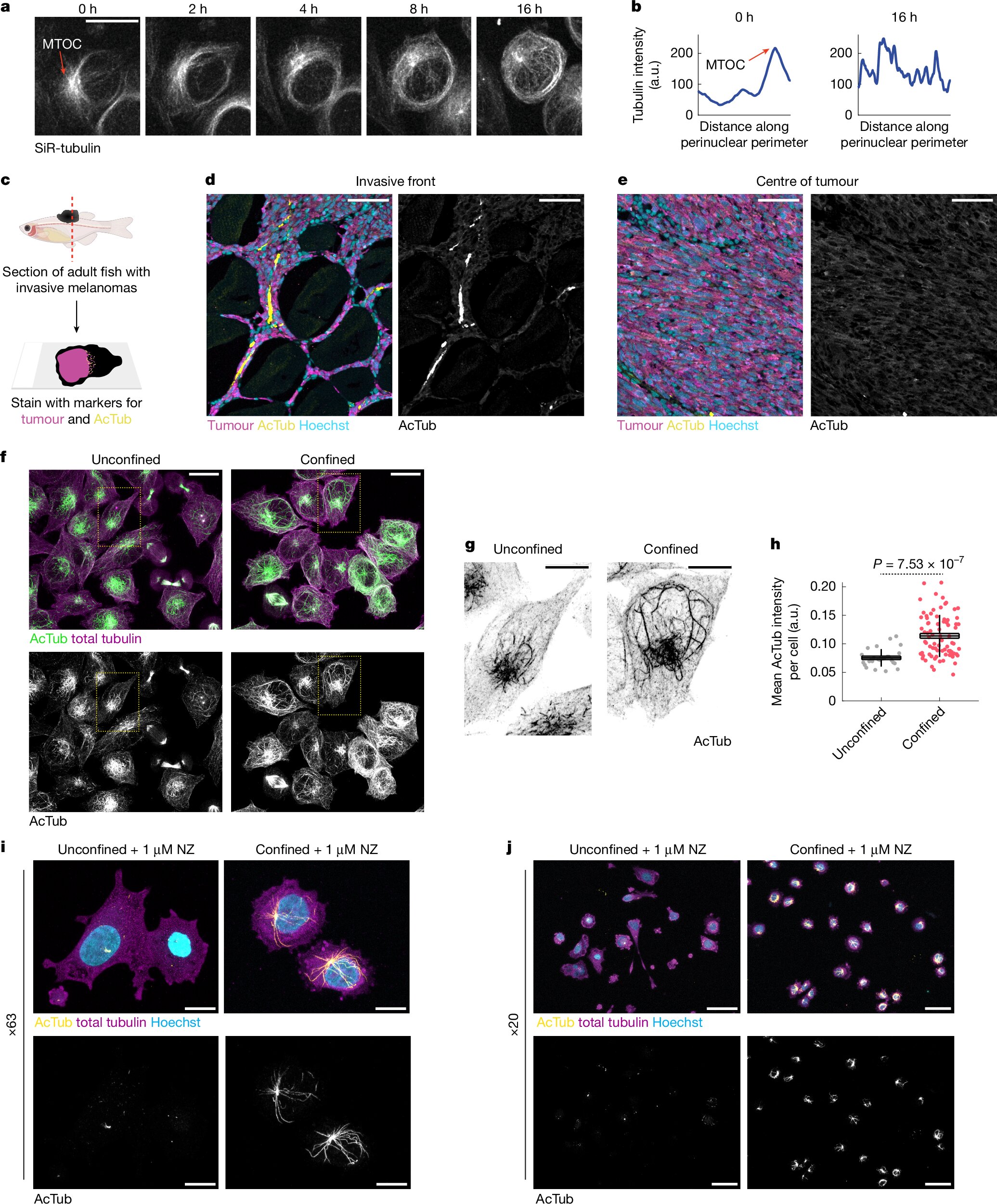 epigenetic changes cancer cells