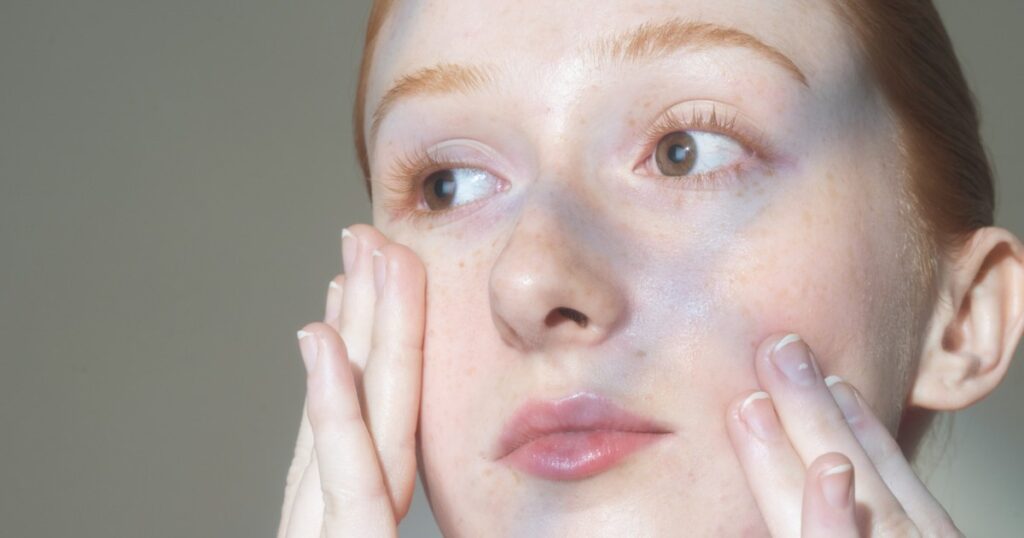 acne treatments