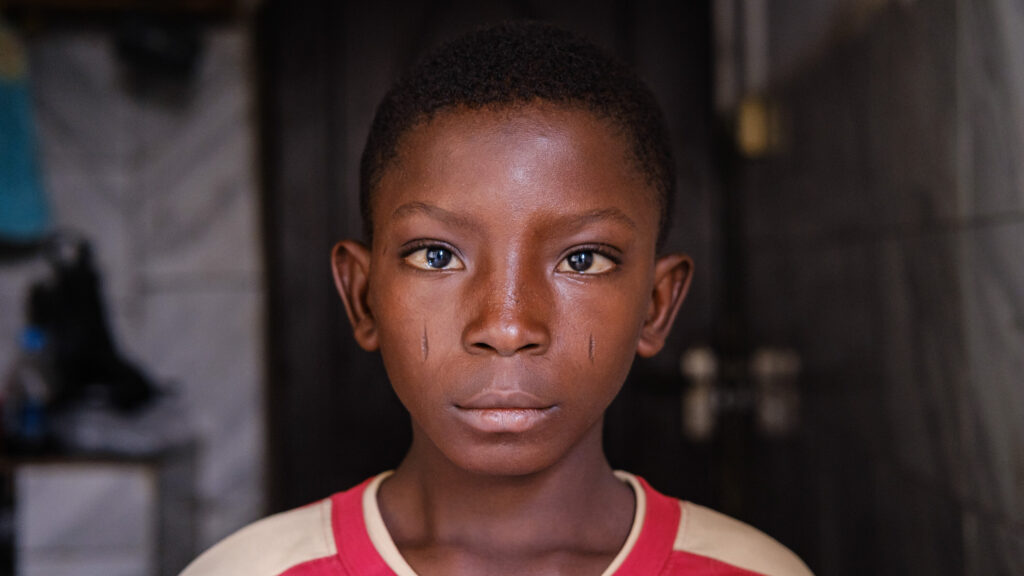schistosomiasis risk