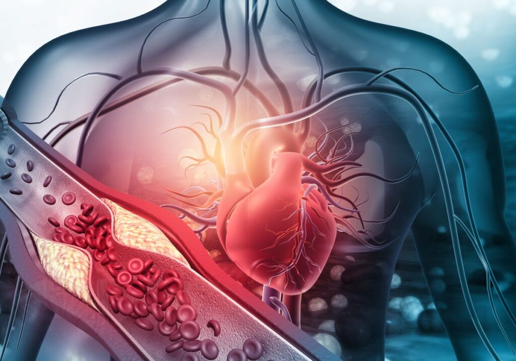 Lipoprotein(a) levels
