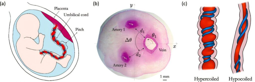 umbilical cord spirals