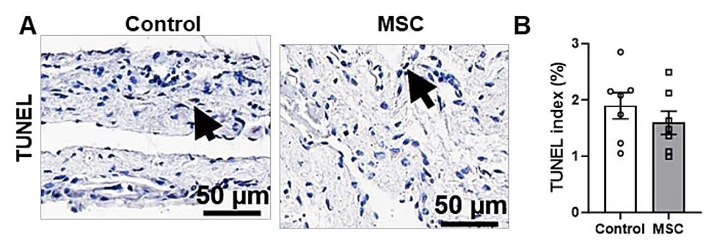 stem cells kidney dialysis