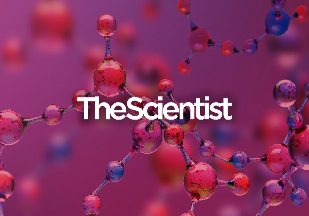 metabolome mass spectrometry