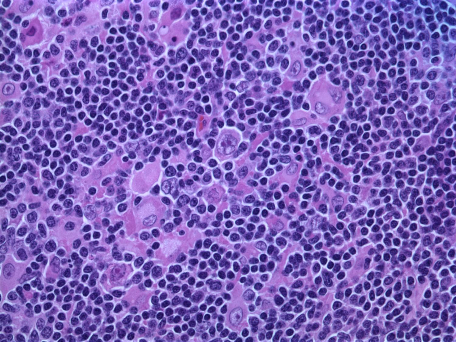 Image source: medicalxpress.com - for informational purposes.
