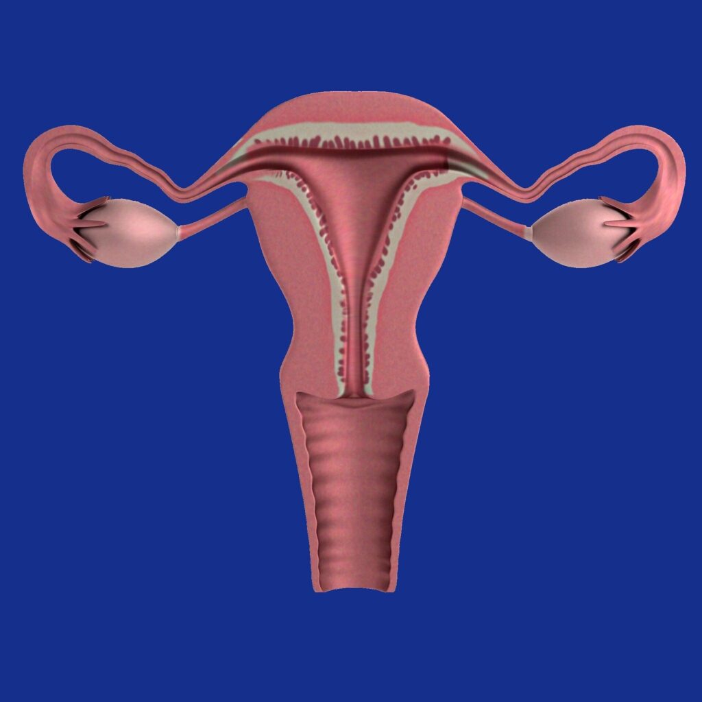 interstitial ectopic pregnancy