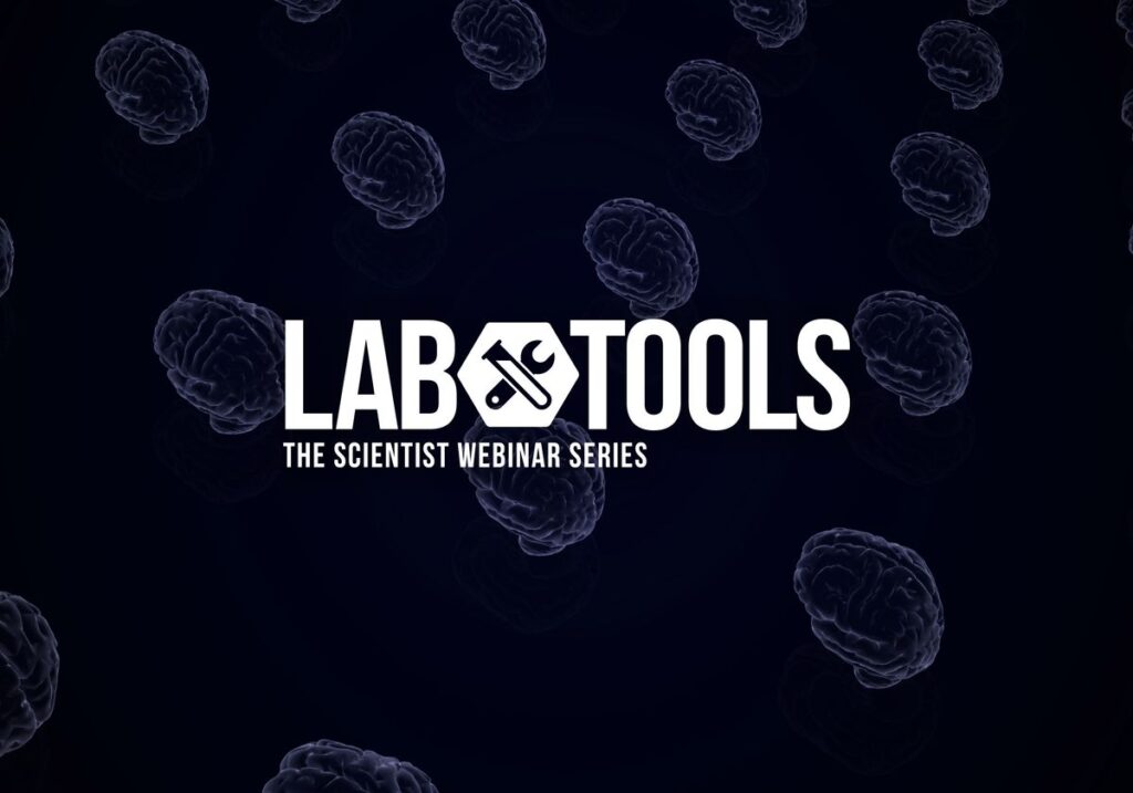 organoids neurological disease