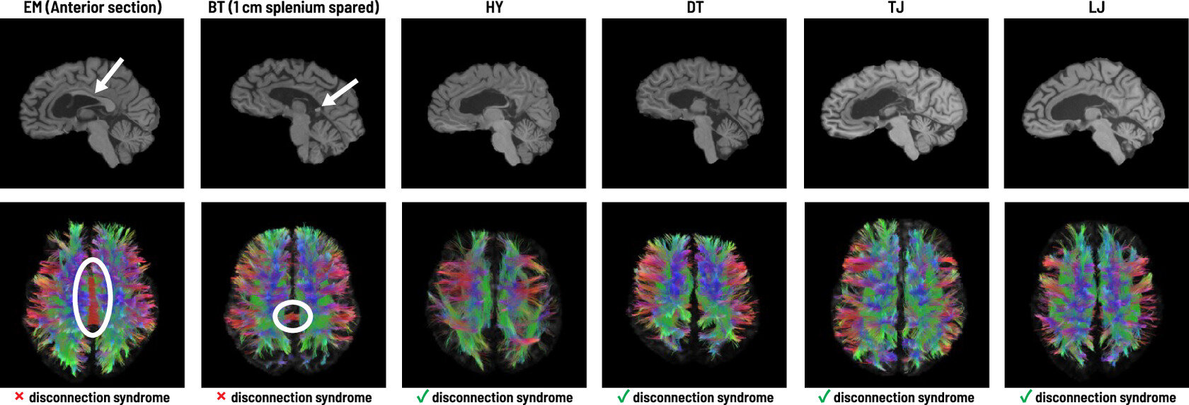 split-brain communication