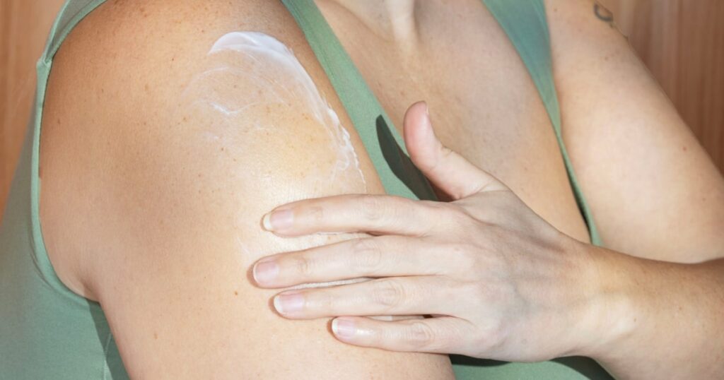 eczema treatment