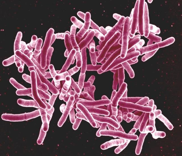tuberculosis vaccine targets