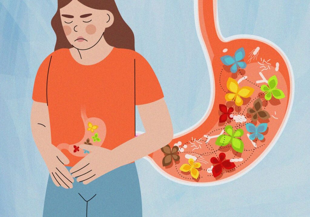 butterflies in the stomach