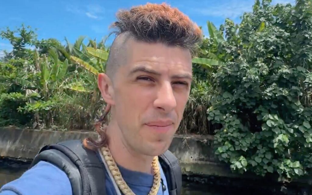 Sam Pepper firework injury