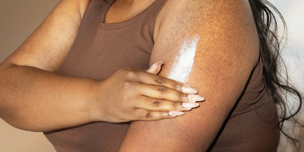 keratosis pilaris treatments