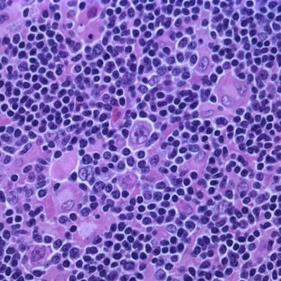 Image source: medicalxpress.com - for informational purposes.