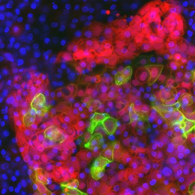 human thymus development