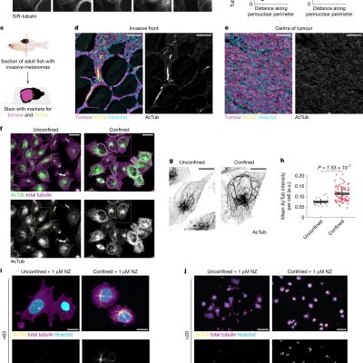 epigenetic changes cancer cells