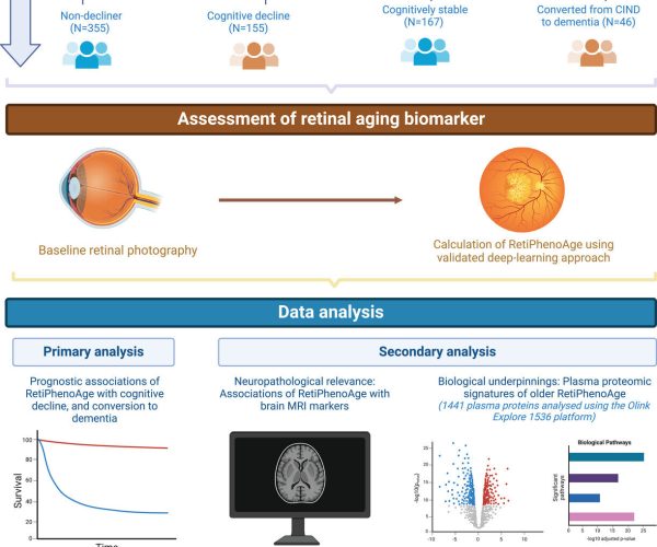 AI eye scan dementia
