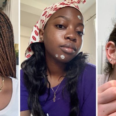 acne spot treatments