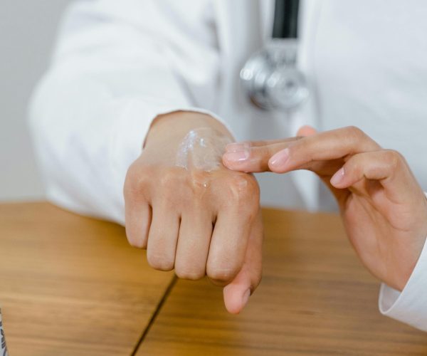 atopic eczema mental health