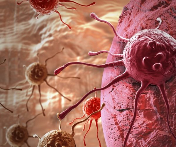 lung tumors immune cells