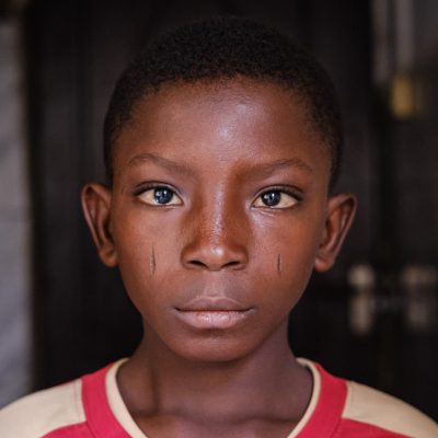 schistosomiasis risk