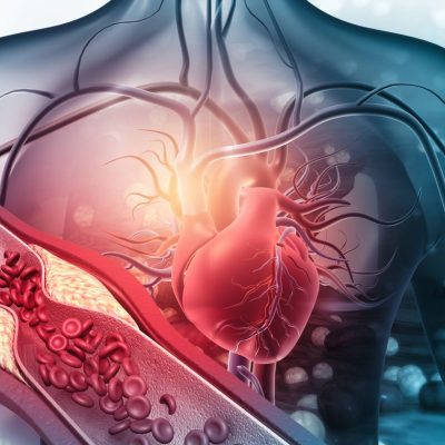 Lipoprotein(a) levels