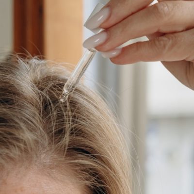 hair thinning treatment