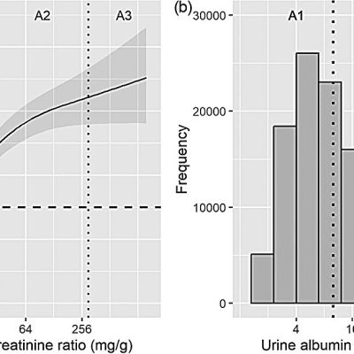 protein in urine dementia