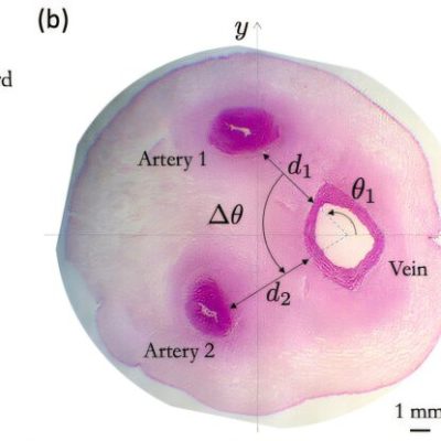 umbilical cord spirals