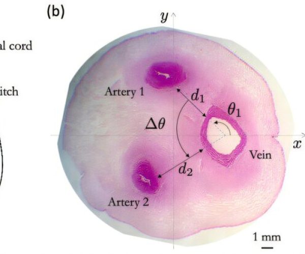 Image source: medicalxpress.com - for informational purposes.