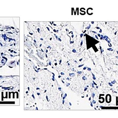 stem cells kidney dialysis