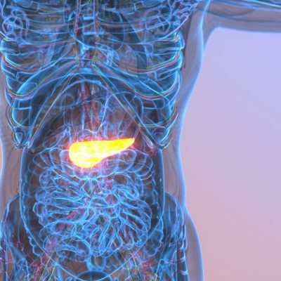 pancreatic cancer therapy