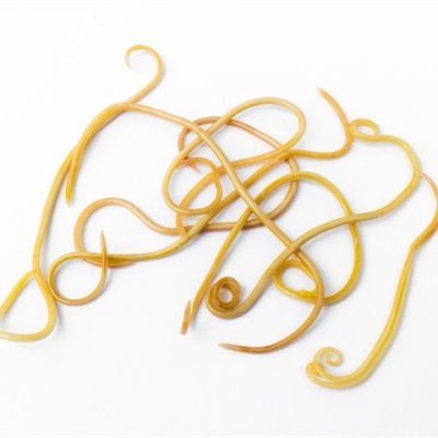 lysosomal activity lifespan