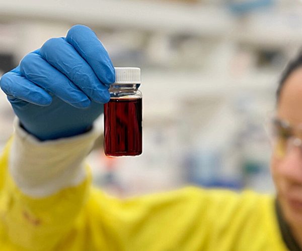 rapid kidney test