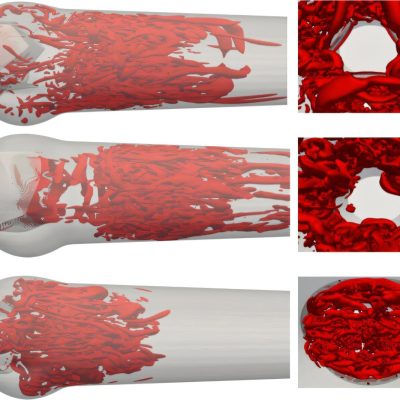 trileaflet mechanical heart valves