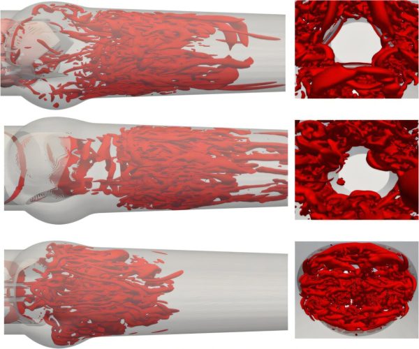 trileaflet mechanical heart valves