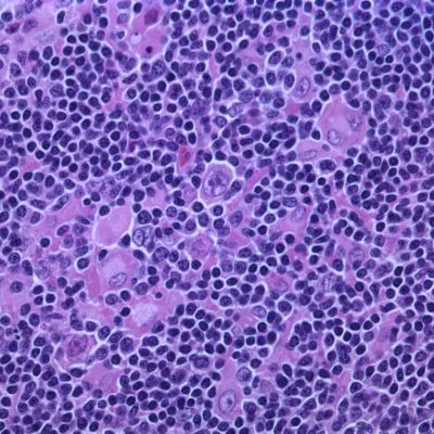 cancer cells gene editors