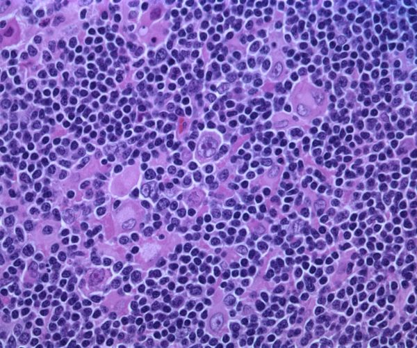cancer cells gene editors