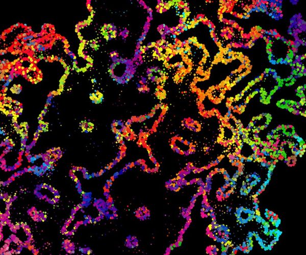 spatial biology
