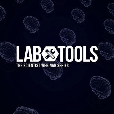 organoids neurological disease