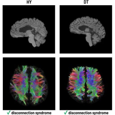 split-brain communication