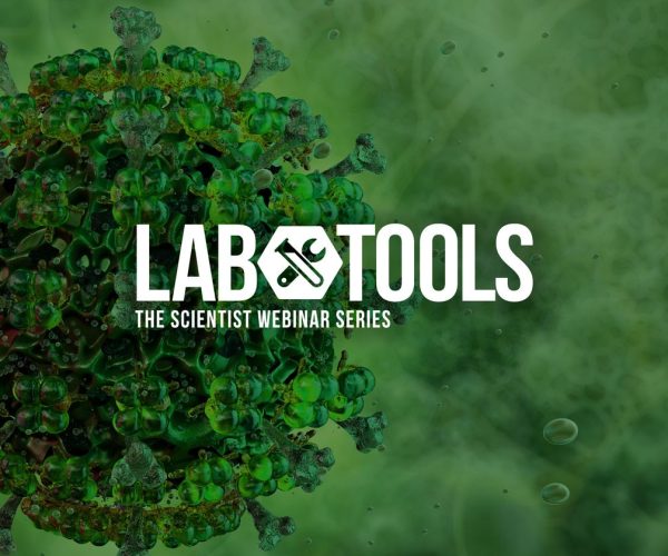 Lentivirus titer