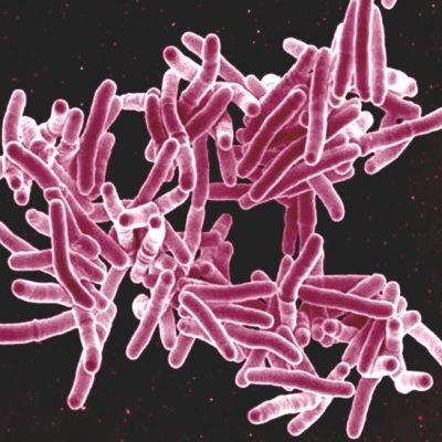 tuberculosis vaccine targets