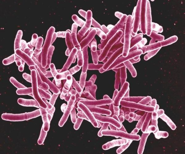 tuberculosis vaccine targets