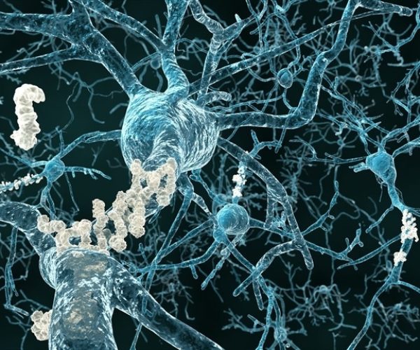 obesity metabolic stress