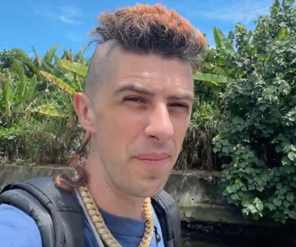 Sam Pepper firework injury