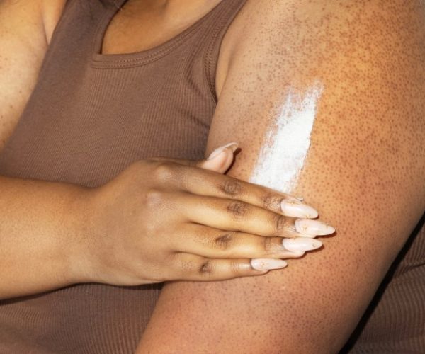 keratosis pilaris treatments