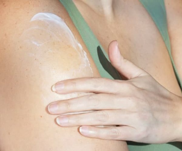 eczema treatment